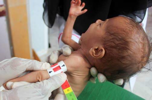 New report warns of inequality of malnutrition in Latin America,