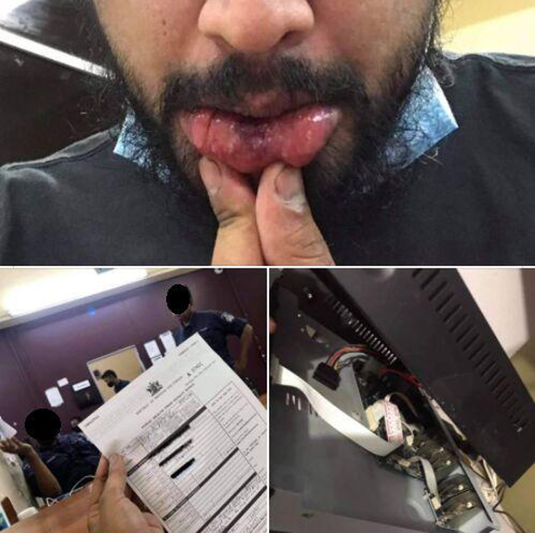 Trinidad man says he tried reporting abuse by woman, and