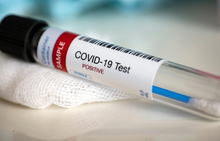 Guyana records 64 new COVID-19 cases; active cases now at