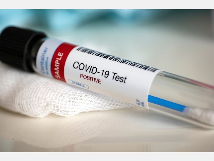 Guyana records 64 new COVID-19 cases; active cases now at