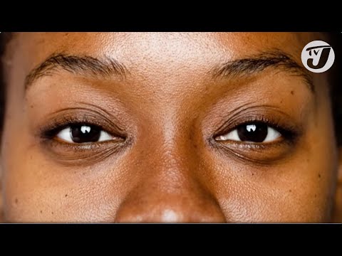 Dermatologists: What Do They Do? Dr. Jonatha Ho Explains | TVJ Smile Jamaica
