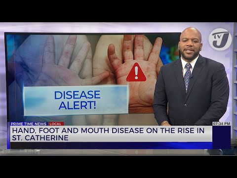 Hand, Foot & Mouth Disease on the Rise in St. Catherine | TVJ News