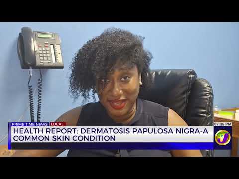 Health Report: Dermatosis Papulosa Nigra-A Common Skin Condition  | TVJ News